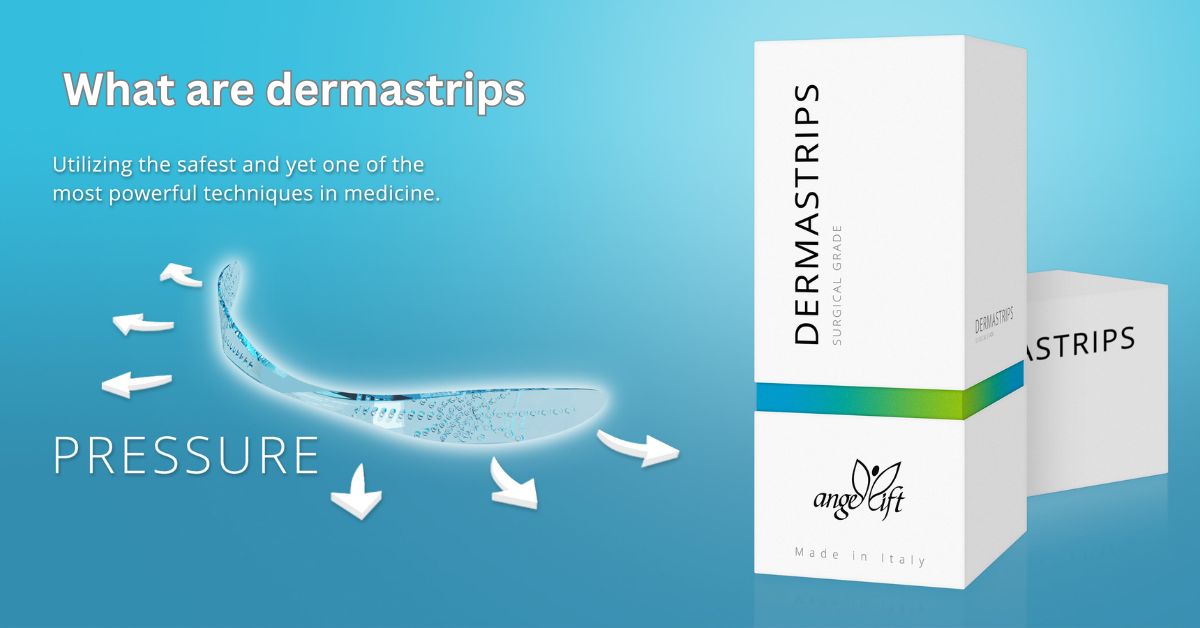 what are dermastrips