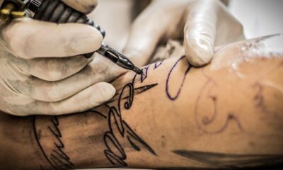 Tattoo Removal