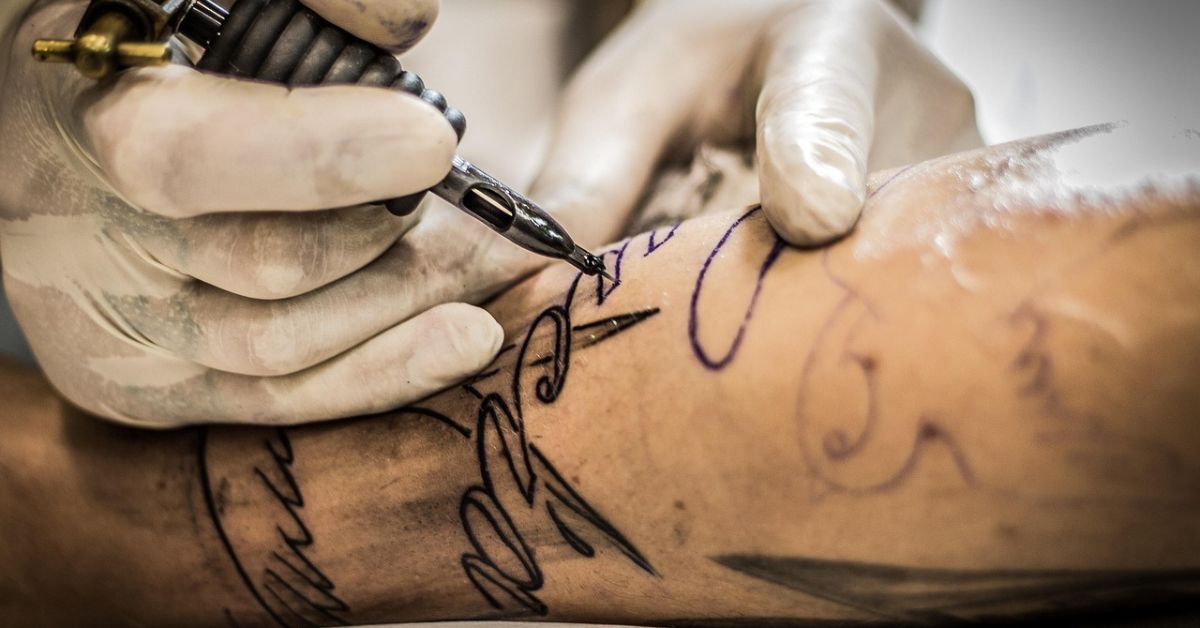 Tattoo Removal