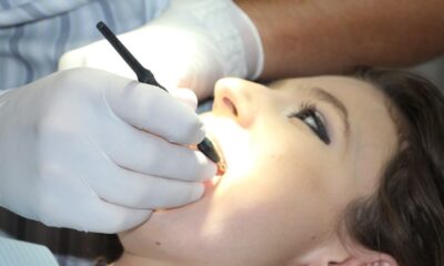 Exposed Tooth Root