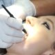 Exposed Tooth Root