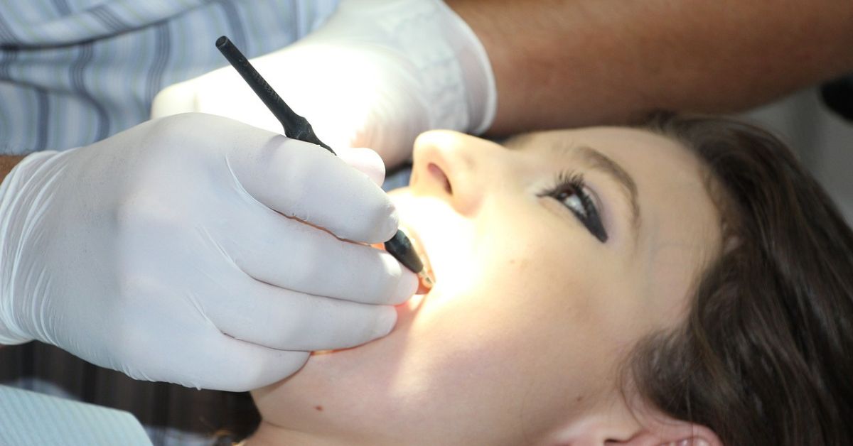 Exposed Tooth Root